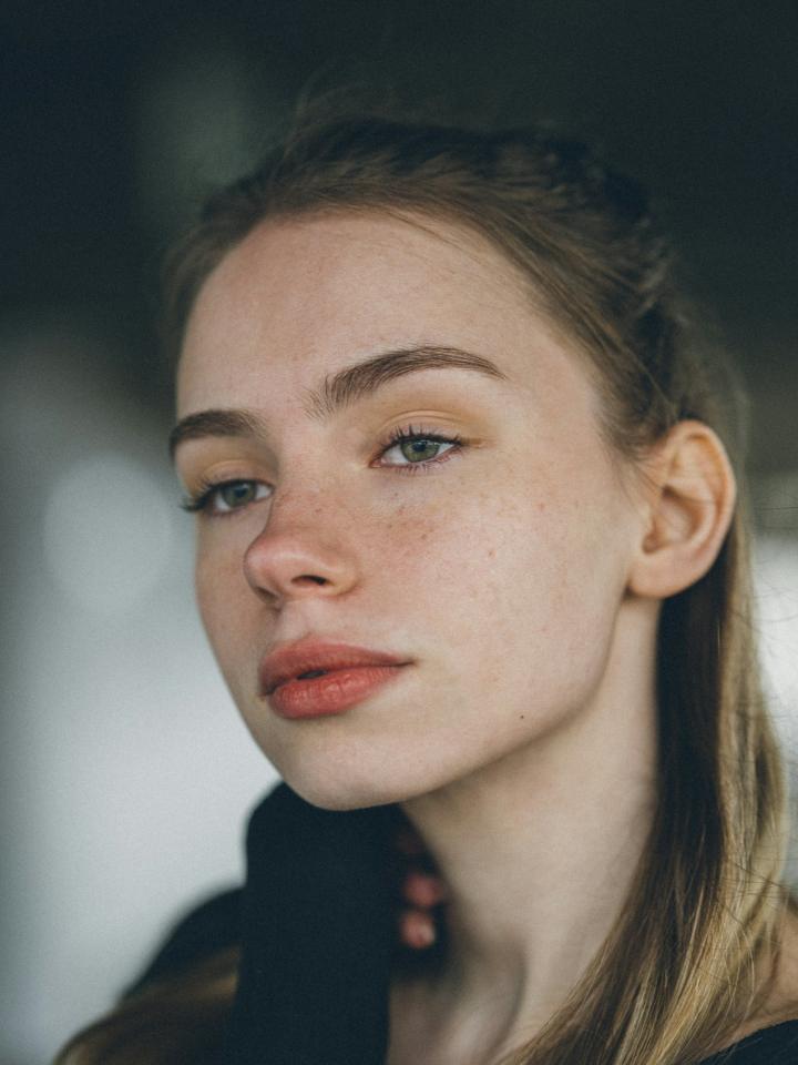 Căng chỉ Collagen nâng cơ