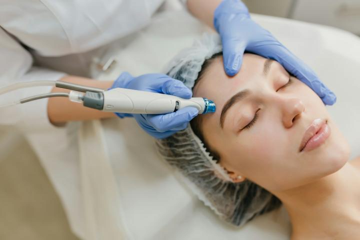 Laser Pico trị nám, tàn nhang